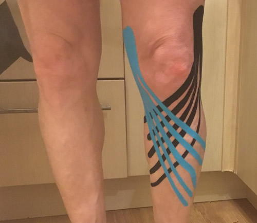 Barbara Boshier | KT Tape Therapy